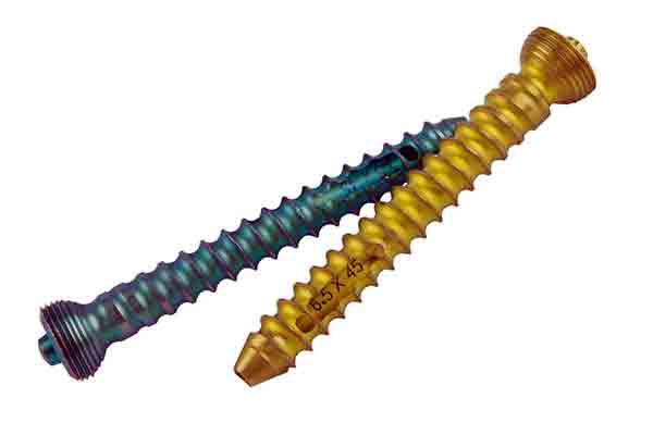 Titanium bone screws