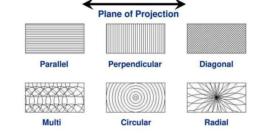 Diagram of surface texture patterns