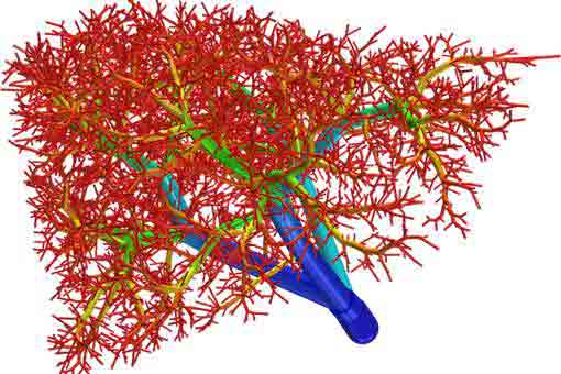 How 3D Printing Is Being Used In Medicine, Part 2